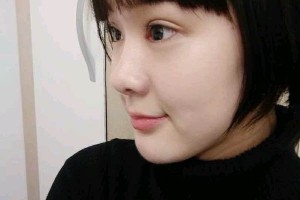 武漢天佑醫(yī)院整形雙眼皮行不行？真人圖片對(duì)比+醫(yī)生推薦