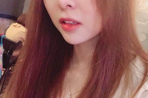 鄭州集美整形醫(yī)院隆鼻真人案例+醫(yī)生介紹！