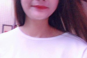 山東濱州市附屬醫(yī)院｜整形科隆鼻真人案例+醫(yī)生介紹