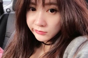 天津一中心整形外科隆鼻怎么樣？真人案例+醫(yī)生介紹