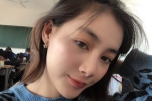 蘇州附二醫(yī)院整形科下頜角術(shù)后果？醫(yī)生推薦&費用表