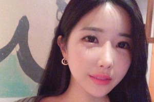 襄陽(yáng)市中心醫(yī)院整形科下頜角術(shù)后果？較新價(jià)格表