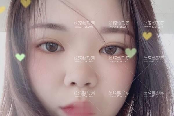 哈爾濱醫(yī)大二院正規(guī)嗎好不好？鼻部手術(shù)價目表和醫(yī)生推薦