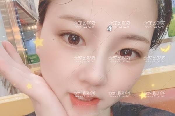 上海生命樹醫(yī)療美容醫(yī)院怎么樣？鼻部手術價目表和醫(yī)生推薦