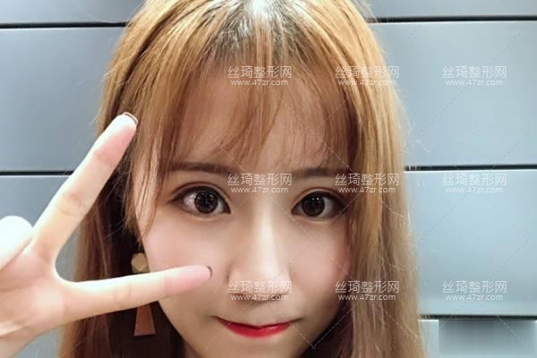 衡陽附一美容科隆鼻怎么樣附手術(shù)介紹專家口碑點(diǎn)評