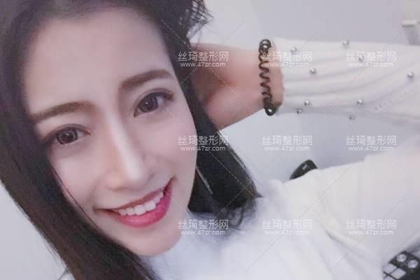 上海華山醫(yī)院整形價目表隆鼻3個月果|整形專家詳情