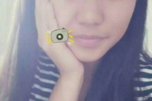 梅州人民醫(yī)院整形科激光嫩膚如何？術后測評-費用表