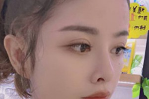 青醫(yī)附院環(huán)境好不好？雙眼皮案例&2021價格表！