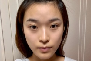 合肥曙光醫(yī)院植發(fā)怎么樣？附2021價格表