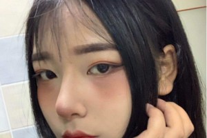 鄭州二附院整形科隆鼻果？手術(shù)案例實拍