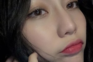 米格醫(yī)療美容醫(yī)院假體隆鼻果？案例+價格表