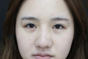 301整形科好不好？醫(yī)院介紹+2021超全價格表