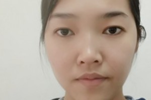 廣州新生毛發(fā)醫(yī)院植發(fā)怎么樣？靠譜嗎？2021價格表