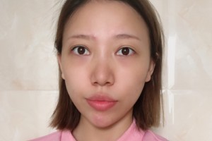 廣州善伊整形口碑如何？醫(yī)生名單+較新費(fèi)用表優(yōu)惠