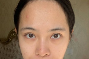 上海九院整形科植發(fā)？掛號難不難網(wǎng)上掛號攻略