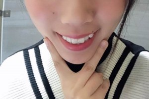 洛陽(yáng)友好口腔口碑｜真實(shí)分享&醫(yī)生介紹