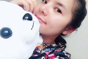 新橋醫(yī)院美容科隆鼻果如何？附術(shù)后圖+價(jià)格表