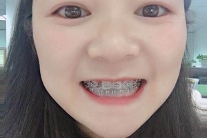 沈陽康貝佳口腔牙齒矯正怎么樣/醫(yī)生介紹+名單！