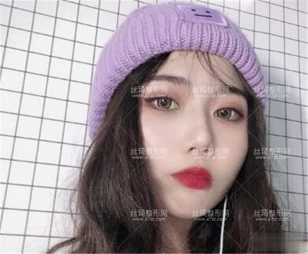 九院整形隆鼻3個月果|整形專家詳情