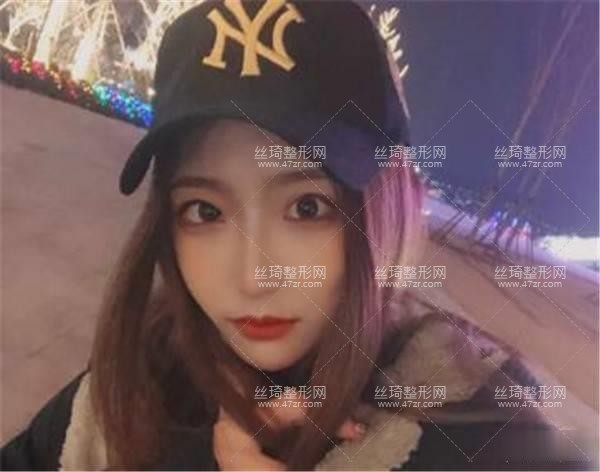 上海第九人民醫(yī)院美容整形科怎么樣？隆鼻實(shí)拍案例圖價(jià)格費(fèi)醫(yī)生口碑