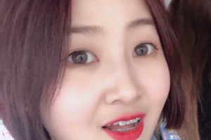 連云港口腔醫(yī)院牙齒矯正價格表｜醫(yī)生介紹