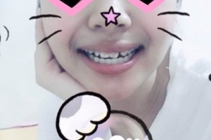 青島可恩口腔醫(yī)院牙齒矯正靠譜嗎？圖片對(duì)比+價(jià)格表