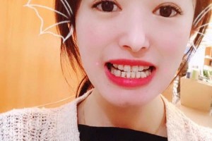 南京雅度口腔醫(yī)院怎么？術(shù)后反饋+醫(yī)生介紹