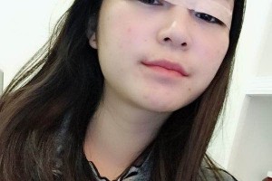 北京黃寺美容外科雙眼皮怎么樣?術后反饋+醫(yī)生介紹