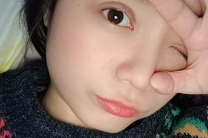 西安西京整形科雙眼皮術(shù)后反饋+醫(yī)生介紹~