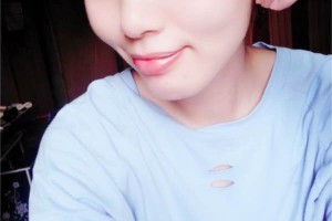 北京協(xié)和整形科｜雙眼皮術后反饋+費用明細