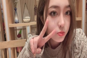 北京藝美醫(yī)療雙眼皮手術(shù)果如何？附2021價格表