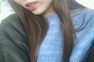 北京117醫(yī)院美容科/鼻部手術真實果圖!