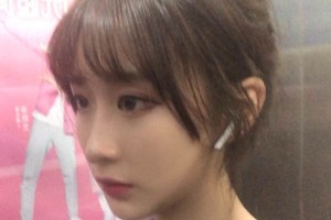 鄭州第一附院整形科靠譜嗎？下頜角真實(shí)案例圖