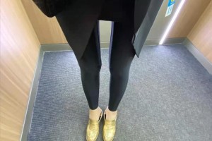 寧波六院整形科溶脂瘦身果如何？附案例圖速看！