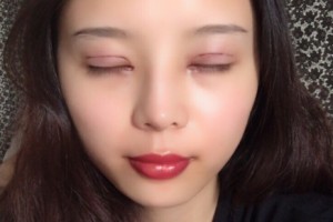 西安星伊美醫(yī)療整形怎么樣？附醫(yī)院簡(jiǎn)介+雙眼皮日記
