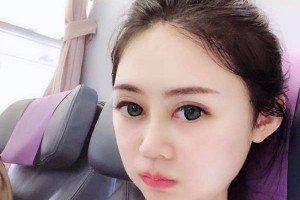 長(zhǎng)沙葉子下頜角整形價(jià)格表？醫(yī)院介紹+醫(yī)生名單！