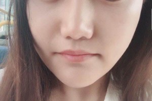 重慶原辰醫(yī)療美容醫(yī)院下頜角怎么樣？醫(yī)生信息介紹