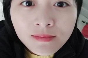 江蘇蘇州薇琳醫(yī)院正規(guī)嗎？下頜角術(shù)后果+價(jià)格表