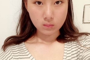 北京協(xié)和醫(yī)院整形外科下頜角醫(yī)生詳細(xì)介紹附價(jià)格表推薦！