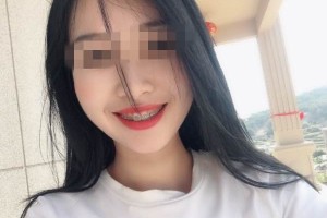 深圳福華口腔是正規(guī)醫(yī)院？牙齒矯正術(shù)案例|醫(yī)生口碑