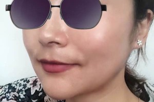 杭州邵逸夫醫(yī)院美容科下頜角好嗎？醫(yī)生介紹！