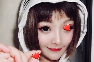 河南省人民醫(yī)院埋線雙眼皮/術(shù)前術(shù)后果對(duì)比！