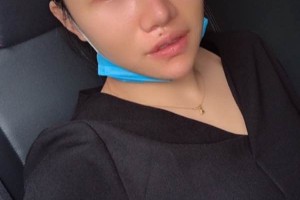 湘雅醫(yī)院皮膚激光中心哪位醫(yī)生好？眼部手術(shù)術(shù)前術(shù)后果對(duì)比！