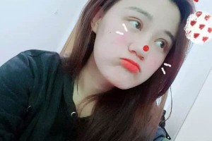 武漢中南整形醫(yī)院切開雙眼皮好嗎？術(shù)后果&價格表