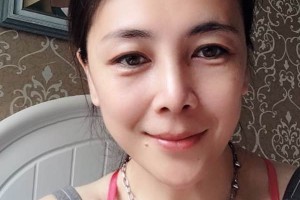 鄭州華領(lǐng)整形醫(yī)院硅膠隆鼻評(píng)價(jià)/術(shù)前術(shù)后果對(duì)比！