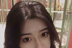 廈門新生毛發(fā)醫(yī)院是正規(guī)嗎？植發(fā)案例+醫(yī)院介紹