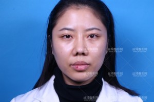 溫州附二醫(yī)激光美容科怎么樣？附案例圖+價(jià)格