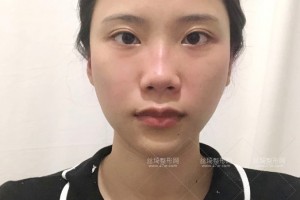 杭州浙一醫(yī)院有做熱瑪吉嗎？附果圖+價(jià)格表