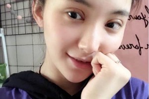 上海千美醫(yī)療美容院定點雙眼皮？術后術前明X果～