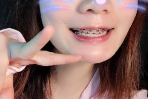 長(zhǎng)沙中諾口腔醫(yī)院/牙齒矯正圖片對(duì)比！